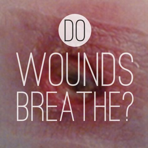 Do Wounds Breathe Open Wound Care, Wound Healing Nursing, Childhood Wounds, Wound Care Nursing, Anti Aging Exercise, Normal Body Temperature, Nursing Books, Wound Dressing, Nursing School Notes