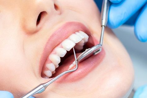 Female at dentist for teeth examination ... | Premium Photo #Freepik #photo #woman #medical #smile #dental Dental Photos, Dental Images, Remedies For Tooth Ache, Dental Check Up, Kedokteran Gigi, Dental Photography, Wisdom Teeth Removal, Emergency Dentist, Dental Cleaning