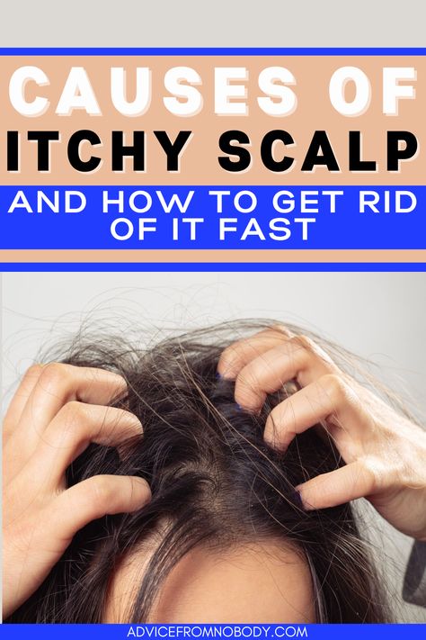 We share why there are so many causes of an itchy scalp and why it can be hard to find the exact reason from psoriasis, eczema, dandruff, and other causes. Plus, some of the most common factors for an itchy scalp and what you can do about it. Experiencing an itchy scalp? Here are some of the causes and remedies. Remedies For Dandruff And Itchy Scalp, Soothe Itchy Scalp, How To Help Itchy Scalp, Causes Of Dandruff, Scalp Dryness Remedies, Flaky Hair Remedies Dry Scalp, Dandruff And Itchy Scalp Remedy, Scalp Care Itchy, Natural Remedies For Itchy Scalp