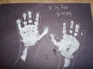 Reformed Ragamuffin: Kids: X is for X-ray (Doctor theme) Doctor Infant Crafts, Doctor And Nurses Activities Eyfs, Doctor Craft For Preschool, Doctors And Nurses Preschool, Qtip Crafts For Kids, Emergency Services Eyfs Activities, Emergency Services Activities For Kids, Doctor Crafts For Toddlers, Doctor Activities For Toddlers