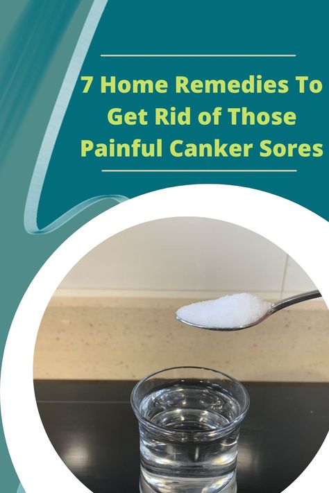 Are canker sores killing you? These are the most simple and effective home remedies you can try. They will relieve your pain and help your sores heal. Canker Sore Remedy For Kids, Canker Sore Remedy Overnight, Canker Sore Remedies, Canker Sore Home Remedies, Canker Sore Remedy, Canker Sore, Whats Good, Simple Home, Nutrition Advice