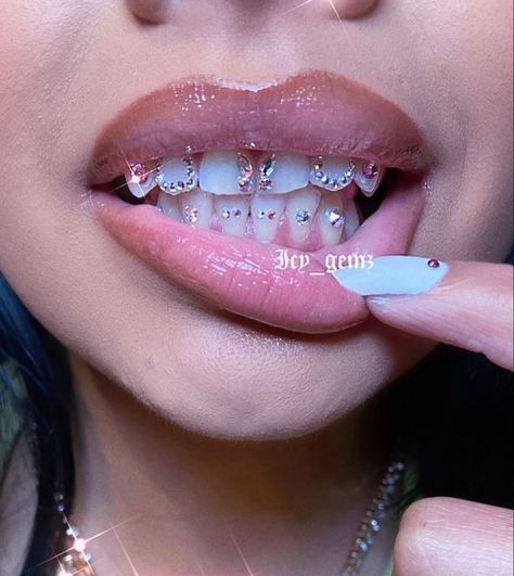 butterfly teeth gem | teeth jewelry in 2022 | Teeth jewelry, Tooth gem, Jewelry Tooth Gems On Invisalign, Bottom Teeth Gems, Strass Teeth, Teeth Gems Aesthetic, Diamond Tooth Gem, Teeth Gems Ideas, Piercing Dental, Tooth Gem Designs, Gem Teeth