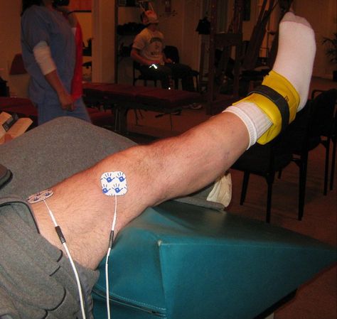 This patient is benefiitting from both passive physical therapy (notice the electrotherapy being used on his leg) in addition to active physical therapy (exercise). Both active and passive physical therapy practices are designed to increase movement while reducing pain. http://www.monmouthspine.com/physical_therapy.html Physical Therapy Exercises, In Addition, Physical Therapy, Being Used, Delicate Bracelet, Quick Saves