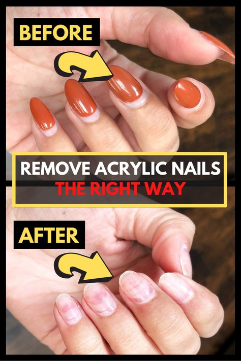 Soak Off Acrylic Nails, Take Off Acrylic Nails, Remove Fake Nails, Nails After Acrylics, Toes Nails, Solar Nails, Remove Acrylics, Gel French Manicure, Gel Nail Removal