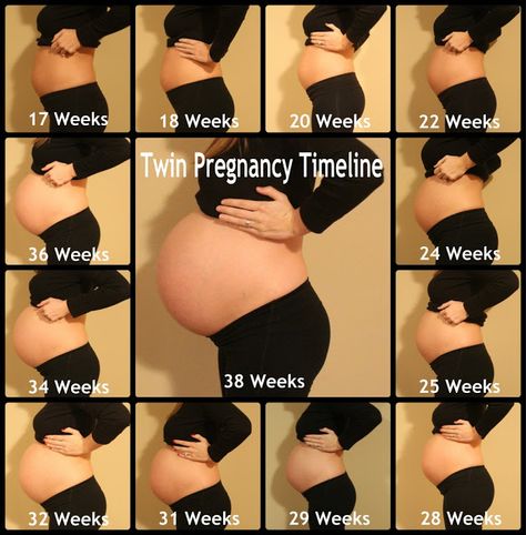 Pregnancy Belly Growth, Bump Progression, Twin Belly, Twin Pregnancy Belly, Baby Bump Progression, Pregnancy Chart, Pregnancy Timeline, Belly Photos, Fraternal Twins