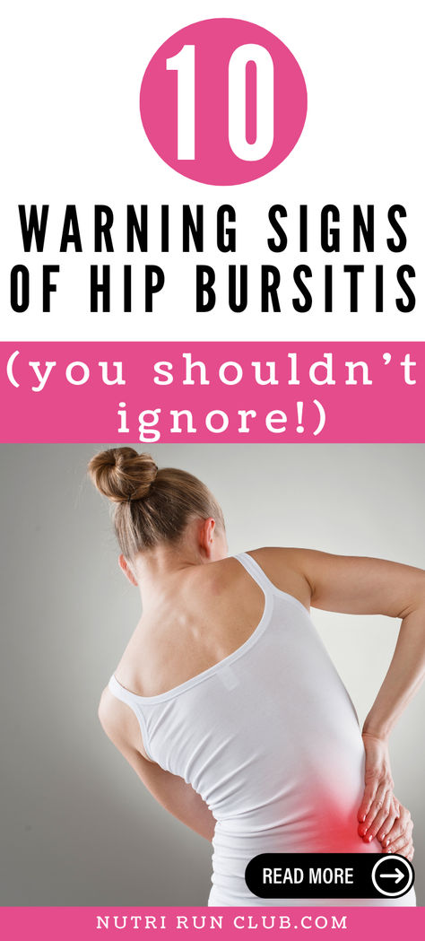 We bring you the Ultimate Guide with the Best Tips for Dealing with Bursitis Hip! Discover what bursitis in the hip is, its causes, symptoms, and diagnosis. Learn effective management strategies for hip joint inflammation in our comprehensive guide. Don't let hip pain hold you back! We got you. Read more: exercises for bursitis in hip, bursitis hip symptoms, bursitis in hip, bursitis hip stretching, how to treat bursitis in the hip, bursitis of hip, bursitis hip cause, bursitis in the hip... What Is Bursitis Hip Pain, Exercises For Bursitis In The Hip, Bursitis Hip Relief, Hip Pain Causes, Effective Management, Bursitis Hip, Body Inflammation, Runners Knee, Hip Injuries