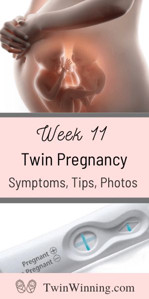 5 Weeks Pregnant Belly, 5 Weeks Pregnant Ultrasound, Early Signs Of Twins, Week 5 Pregnancy, Twin Ultrasound, Twin Pregnancy Symptoms, Twins Ultrasound, Twin Belly, Twin Pregnancy Belly