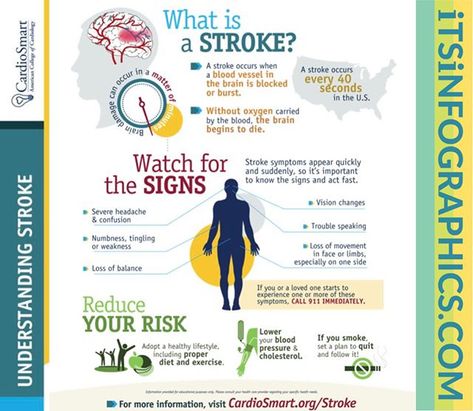 #Infographics  Do you know what a stroke is and what signs to look for?  #Infographic   .  #stroke #strokesurvivor #strokeawareness #strokesurvivor .  itsinfographics.com . . #Infographic Human Body Unit Study, Infographic Posters, Types Of Strokes, Healthy Heart Tips, Nursing School Essential, Loss Of Balance, Human Body Unit, Body Pain Relief, Read People