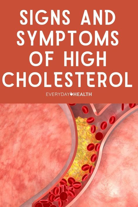 High cholesterol is a condition that occurs when levels of cholesterol in your blood are elevated enough to cause health problems, including heart disease and stroke. Sometimes known as hyperlipidemia, high cholesterol is painless and doesn’t cause any symptoms until a person develops severe heart disease. #HealthTips #FitnessTips #HealthyLiving #SelfCare #FitLife #NutritionTips #Wellness #HealthyLifestyle High Cholesterol Symptoms, Ways To Lower Cholesterol, Lower Cholesterol Naturally, Cholesterol Symptoms, Cholesterol Foods, Low Cholesterol Diet, High Cholesterol Levels, Low Cholesterol Recipes, Cholesterol Remedies