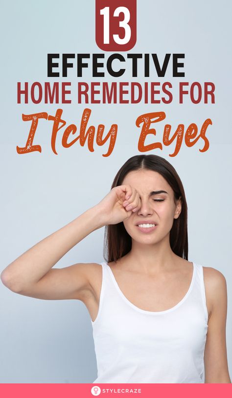 Itchy Eyes Remedy Allergies, Itchy Eyes Remedy, Remedies For Itchy Eyes, Itchy Eyelids, Allergy Eyes, Irritated Eye, Allergy Remedies, Home Remedy For Cough, Eye Sight Improvement