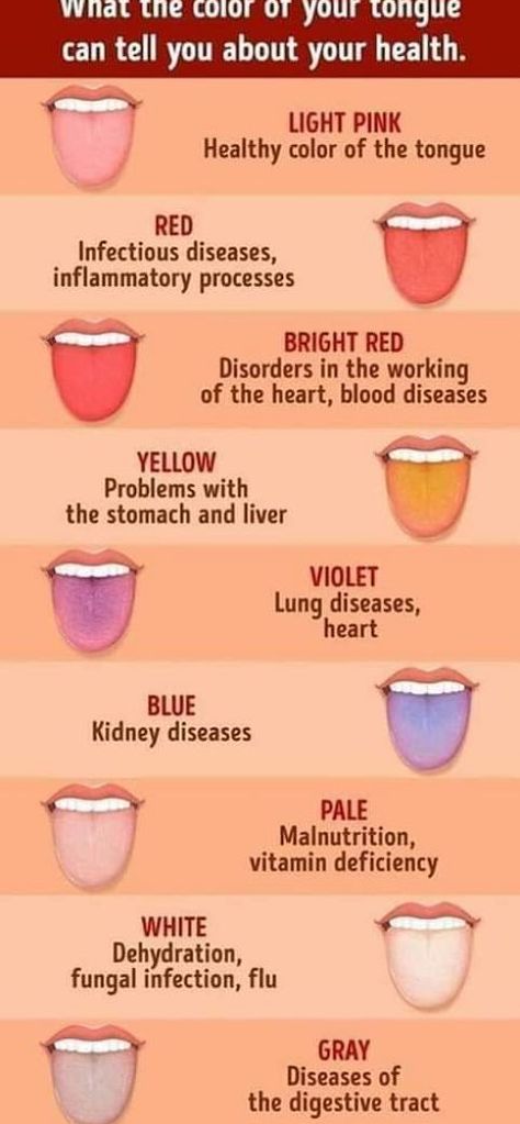 Find Out What Your Tongue Is Trying to Tell You Healthy Tongue, Healthy Colors, Vitamin Deficiency, Health Signs, Tongue Health, Healthy Advice, Lung Disease, Nail Care Tips, Striped Nails