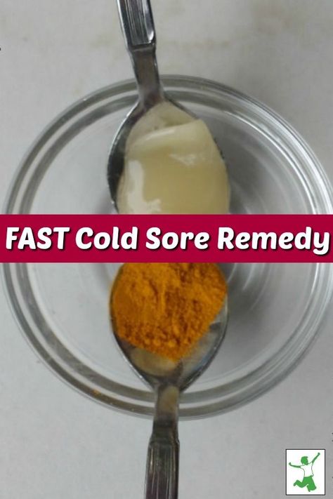 Cold sores or fever blisters, most people get them. There are some wonderful natural remedies to help with the cold sores. Come find out about three fast cold sore remedies that you could be using today! #coldsores #coldsoreremedies #coldsoreremedy #feverblisters #feverblisterremedy #feverblisterremedies #naturalremedies #mrsjonescreationstation Cold Sore Remedy Fast, Heal Cold Sores Fast, Fever Blister Remedy, Cold Sore Remedies, Baby Cold Remedies, How To Heal Blisters, Home Remedies For Cold, Home Remedies For Fever, Natural Remedies For Fever