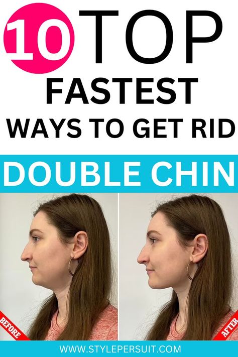 A double chin, also known as submental fat, is a common concern for many people. It occurs when a layer of fat forms below the chin, resulting in a fuller appearance. While genetics, aging, and weight gain play significant roles in the development of a double chin, there are several strategies and exercises you can incorporate into your routine to help reduce its appearance. Explore effective methods for getting rid of a double chin and achieving a more defined jawline. Neck Fat Exercises, More Defined Jawline, Defined Jawline, Rid Of Double Chin, Jawline Exercise, Double Chin Exercises, Chiseled Jawline, Reduce Double Chin, Chin Exercises