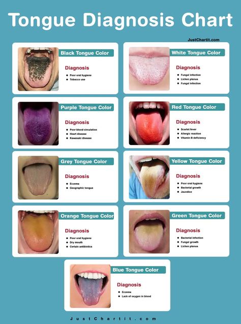 Tongue Color Meaning, Tongue Anatomy, Chinese Tounge Health, Tongue Infection, Tongue Health Chart, Tongue Cleaning, Tongue Chinese Medicine, Tongue Problems, Structure Of Tongue