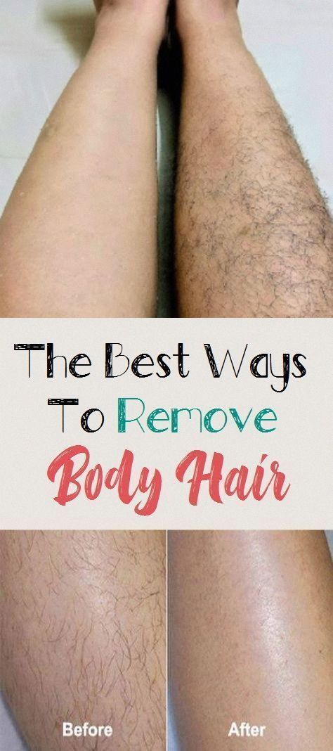 6 Easy Ways to Remove Hair on Legs Younique Skin Care, Leg Hair Removal, Remove Hair, At Home Hair Removal, Women Health Care, Body Hair Removal, Unwanted Hair Removal, Hair Food, Amazing Home