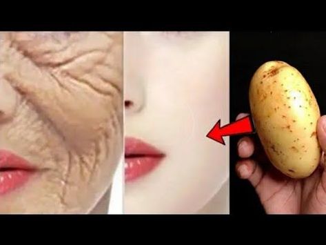 Aging Skin Remedies, Wrinkles Remedies Face, Obličejové Masky, Anti Aging Remedies, Wrinkle Remedies, Natural Beauty Remedies, Anti Aging Wrinkles, Skin Care Wrinkles, Face Wrinkles