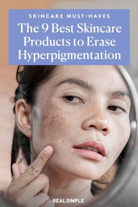 Hyperpigmentation Mask, Removing Hyperpigmentation, Spot Remover For Face, Age Spots On Face, Best Dark Spot Corrector, Cream For Dark Spots, Dark Spots On Face, Brown Spots Removal, Brown Spots On Face