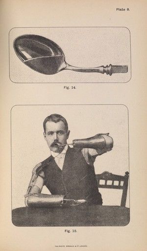 spoon | Image search | Wellcome Collection Prosthetic Device, Survival Stuff, Vintage Science, Wellcome Collection, White City, Clip Art Vintage, Reasons To Live, The Body, Fig