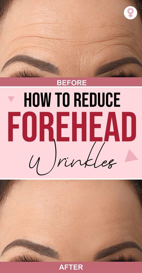 Reduce Forehead Wrinkles, Gallbladder Removal, Wrinkle Remedies, Wrinkle Free Skin, Forehead Wrinkles, Skin Care Wrinkles, Face Wrinkles, Prevent Wrinkles, Best Anti Aging