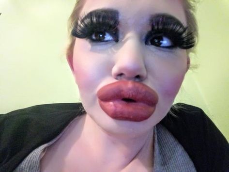 Woman Quadruples Her Lips To Have ‘Biggest In The World’ Huge Lips Injections, Huge Lip Fillers, Full Lips Natural, Full Lips Makeup, Overlined Lips, Pout Face, Big Eyelashes, Funny Lips, Eyebrow Slits