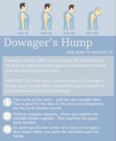 Shoulder Exercises Physical Therapy, Dowager's Hump, Back Strengthening Exercises, Neck And Shoulder Exercises, Neck Hump, Chin Tuck, Bad Posture, Strengthening Exercises, Easy Yoga Workouts