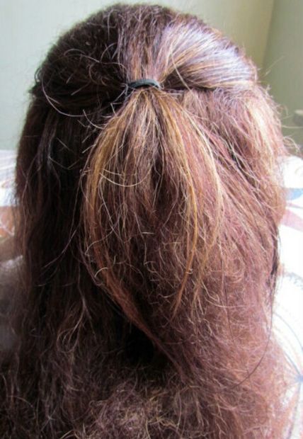 Picture of fizzy hair? Natural Hair Removal Remedies, Fizzy Hair, Back Acne Remedies, Remove Skin Tags Naturally, Acne Makeup, Pimples Remedies, Underarm Hair Removal, Get Rid Of Blackheads, Unwanted Hair Removal