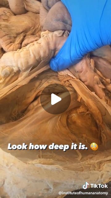 Dr. Tom Walters, DPT, OCS on Instagram: "💥𝐏𝐬𝐨𝐚𝐬 𝐀𝐧𝐚𝐭𝐨𝐦𝐲💥 —— 👉Can you really release the psoas muscle with massage techniques? Probably not. This video from @instituteofhumananatomy highlights just how deeply this muscle is located. - 🔎Psoas major is the deepest core muscle and the only muscle that attaches the trunk to the lower limb. It runs from the vertebrae and discs of the low back (T12-L5) down to the lesser trochanter on the inside of the femur. This unique configuration allows psoas to possess the dual role of spinal stabilizer and hip flexor. - 🧠If you are experiencing pain in the low back, sacroiliac joint region or hip, it is worth your time to determine whether or not addressing your hip flexors may help. This can be most easily accomplished by adding a bit of Hip Flexor Muscles Anatomy, Lower Back Massage Techniques, Psoas Stretch Release, Lower Limb Anatomy, Hip Muscles Anatomy, Psoas Muscle Pain, Psoas Major, Knee Mobility, Psoas Stretch