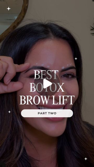 Eye Brow Lift Before And After, Brow Lift Botox Eyebrows, Botox Brow Lift Before And After, Botox Brow Lift, Botox Before And After, Eyelid Lift, Brow Lift, Aging Gracefully, Beautiful Skin