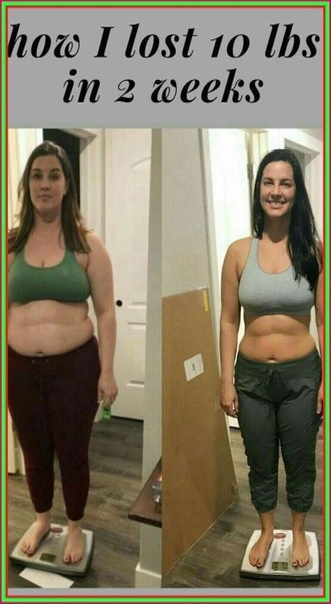 How i lost 10 lbs in 2 weeks. #Lose #10 #lbs #in #or #Unrealistic #FitnessTips #FitLife #2 #Wellness #Weeks #Achievable Lose 10 Lbs, Diet Keto, Losing 10 Pounds, Stubborn Belly Fat, 10 Pounds, Lose Belly, Healthy Weight, Lose Belly Fat, Losing Me