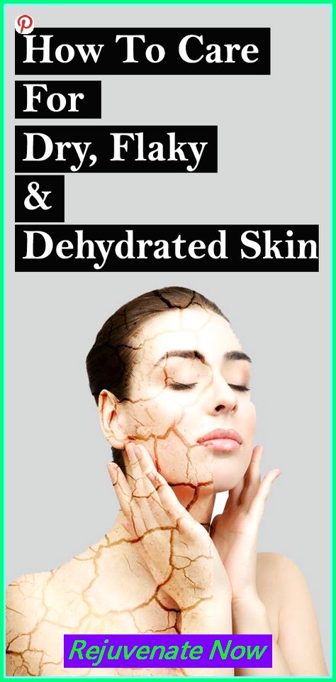 🌹 Unlock Timeless Beauty: Embrace Youthful Skin with Kollagen Intensiv! get rid of wrinkles on face home remedies, wrinkle remover anti aging, how to get rid of wrinkles on face remedies 😘 Please re-pin 😍💞 #youthfulskin #bestskincare #skinprotection Dry Skin Body Remedies, How To Take Care Of Dry Skin, What Helps Dry Skin On Face, How To Get Clear Skin For Dry Skin, Natural Face Mask For Dry Skin, Diy Dry Skin Face Mask, Causes Of Dry Skin, Natural Dry Skin Remedies, Dry Face Skin Remedies