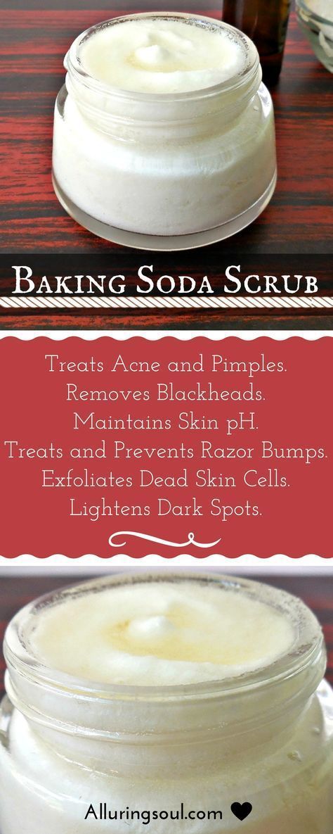 Baking soda is the cheapest ingredient in your pantry that will solve your all skin flaws. Baking soda scrub will provide smooth skin, removes acne, blackheads, razor bumps, dark spots or scars etc. Baking Soda Scrub, Obličejové Masky, Health Coconut Oil, Coconut Oil Uses, Razor Bumps, Baking Soda Shampoo, Scrub Recipe, Acne Remedies, Remove Acne