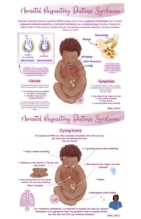 Neonatal Respiratory Distress Syndrome, Nicu Nurse Tips, Postpartum Nursing Notes, Nicu Nurse Study Notes, Respiratory Distress Syndrome Newborn, Nicu Nurse Notes, Nicu Nursing Education, Postpartum Education, Midwifery Aesthetic