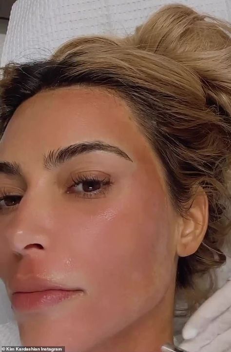 Laser Facial Before And After, Facial Before And After, Face Plastic Surgery, Kim Kardashian Makeup Tutorial, Face Laser, Saving Face, Laser Facial, Kardashian Makeup, Kim Kardashian Makeup