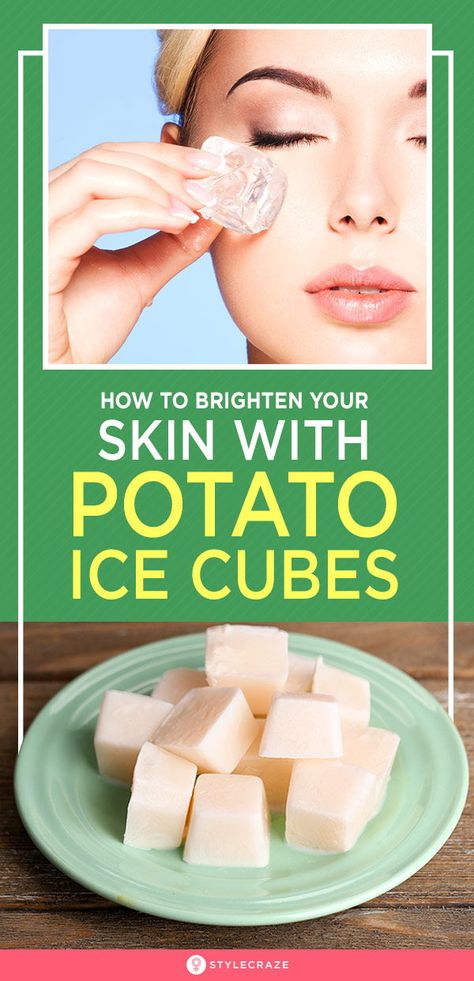 Potato For Skin, Sweet Custard, Potato Juice, Aloe Vera Face Mask, Natural Hair Mask, Beauty Tips And Tricks, Boost Hair Growth, Summer Skin, Brighten Skin