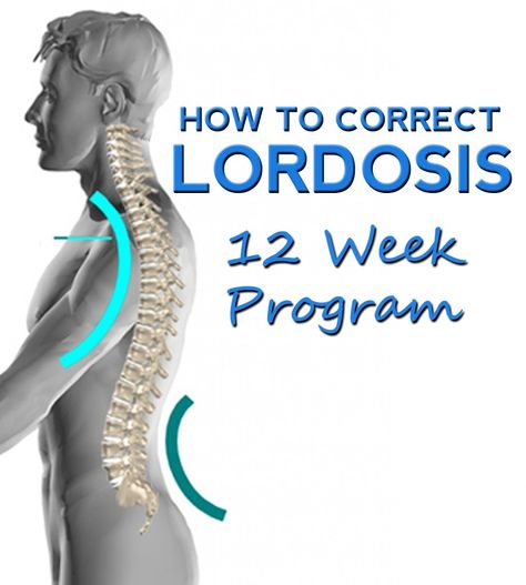 lordosis | How to Correct Lordosis 12 Week Program Lumbar Lordosis, Psoas Release, Tight Hip Flexors, Posture Exercises, Psoas Muscle, Hip Flexors, Everyday Workout, Back Pain Exercises, Better Posture