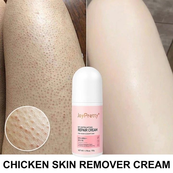 Rough Bumpy Skin, Cream Chicken, Skin Care Basics, Diy Skin Care Routine, Keratosis Pilaris, Bumpy Skin, Perfect Skin Care Routine, Chicken Skin, Body Skin Care Routine