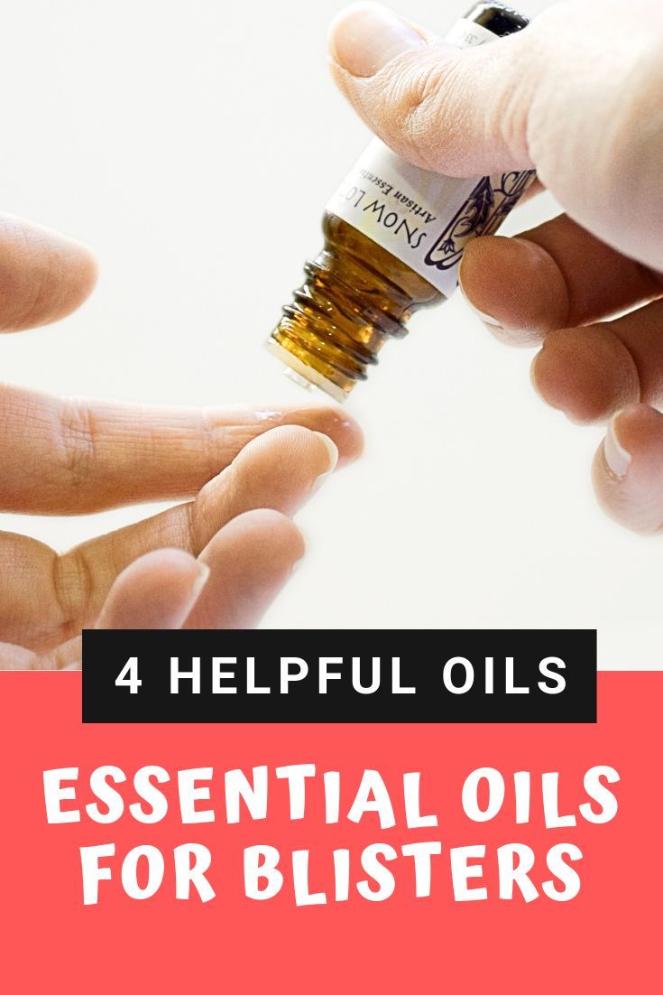 Learn how to naturally treat blisters with this essential oil remedy. Treat blisters on your feet, toes, hands, and lips #blisters #essentialoils #doterra #youngliving #naturalremedy Essential Oils For Blisters, How To Treat Blisters, Heal Blisters, Blister Remedies, Blister On Lip, How To Heal Blisters, Fever Blister, Diy Essential Oil Recipes, Speedy Recovery