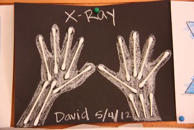 two hands are drawn on a blackboard with white chalk and green marker, which says x - ray