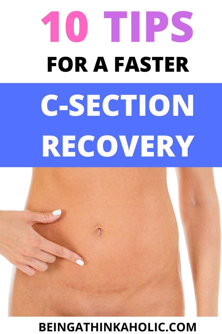 a woman's stomach with the words 10 tips for a faster c - section recovery