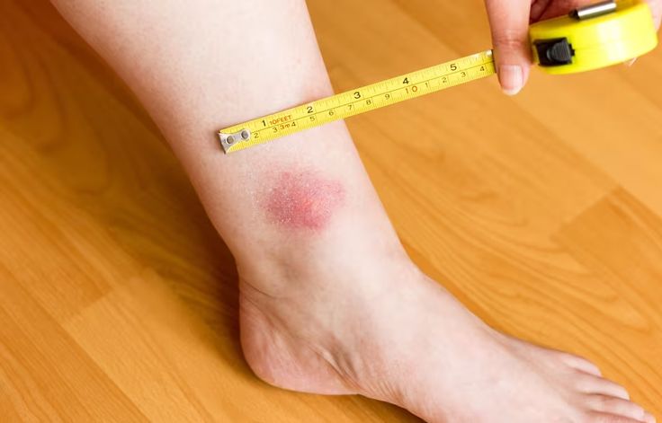 a person with a measuring tape on their foot and thermometer in front of them