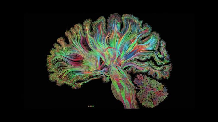 an image of a colorful brain on a black background