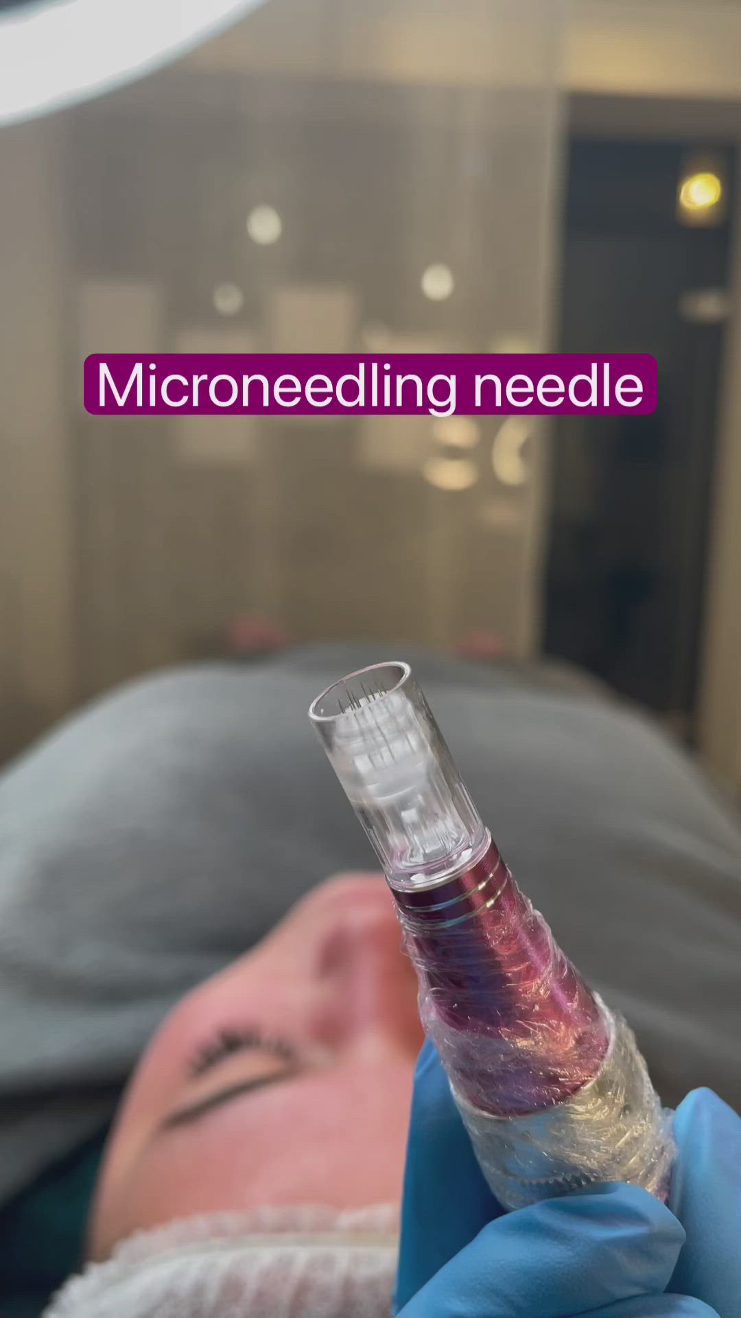 This contains an image of: Microneedling needle 🙌🏽😍