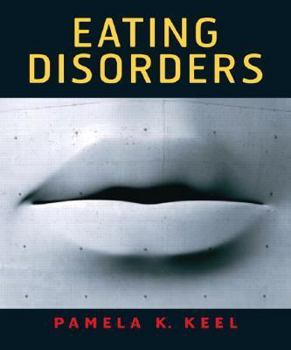 Paperback Eating Disorders Book