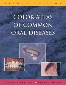 Paperback Color Atlas of Common Oral Diseases Book