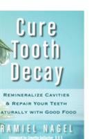 Cure Tooth Decay: Heal and Prevent Cavities with Nutrition