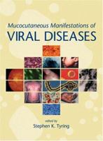 Mucocutaneous Manifestations of Viral Diseases