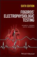 Electrophysiologic Testing