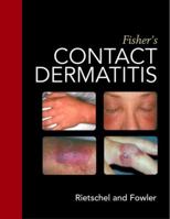 Fisher's Contact Dermatitis