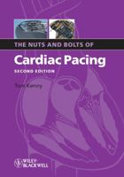 Nuts and Bolts of Cardiac Pacing