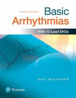 Basic Arrhythmias